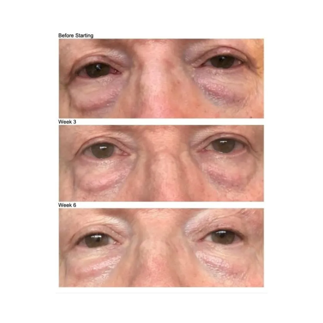FIRMING EYE CREAM