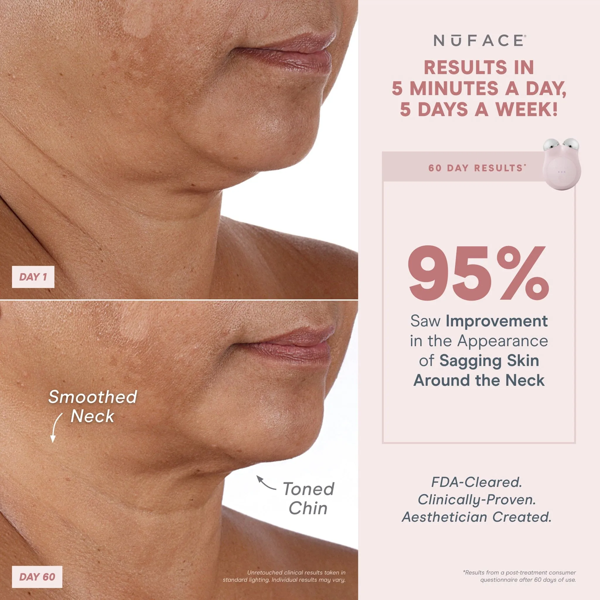 NuFACE Mini  Facial Toning Starter Kit