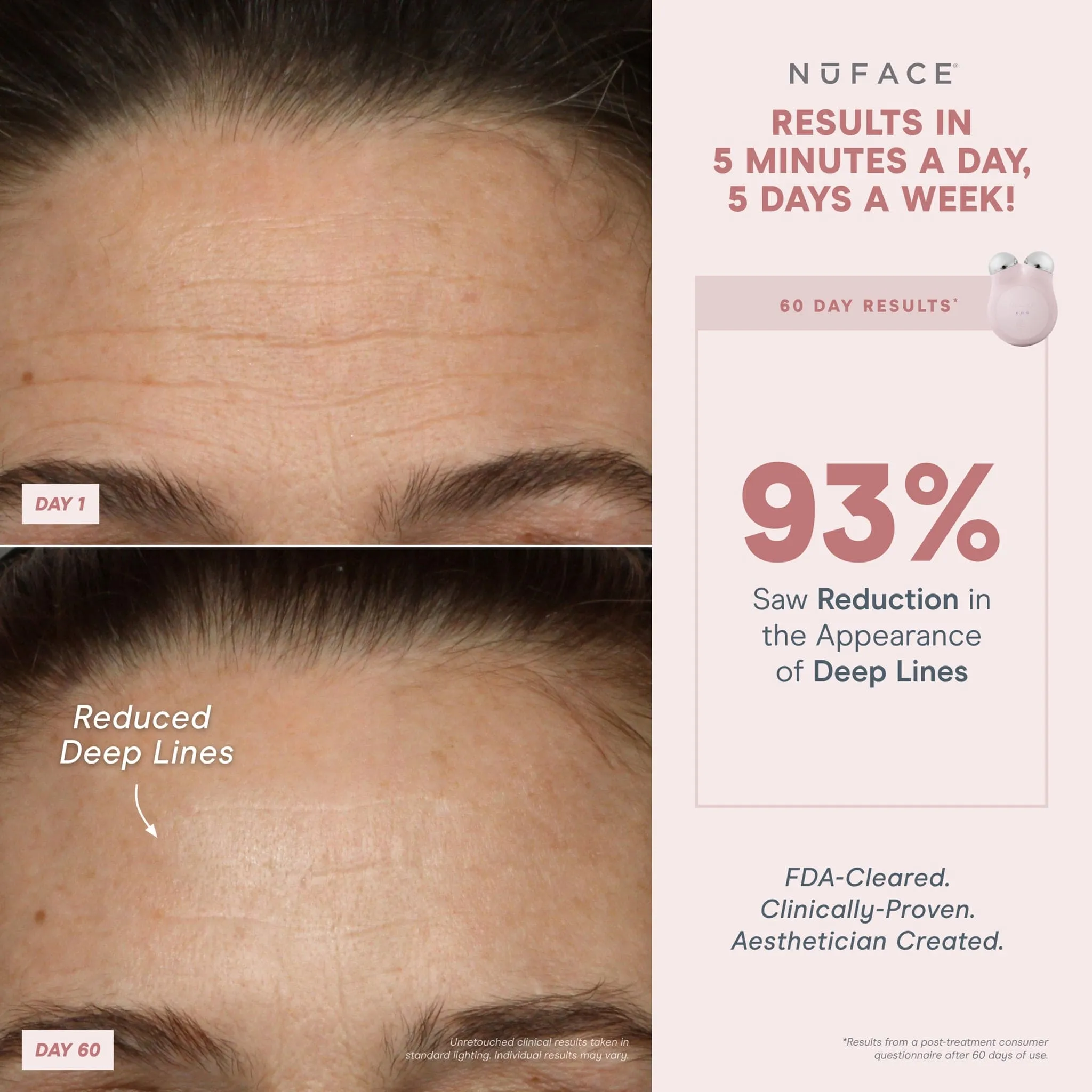 NuFACE Mini  Facial Toning Starter Kit
