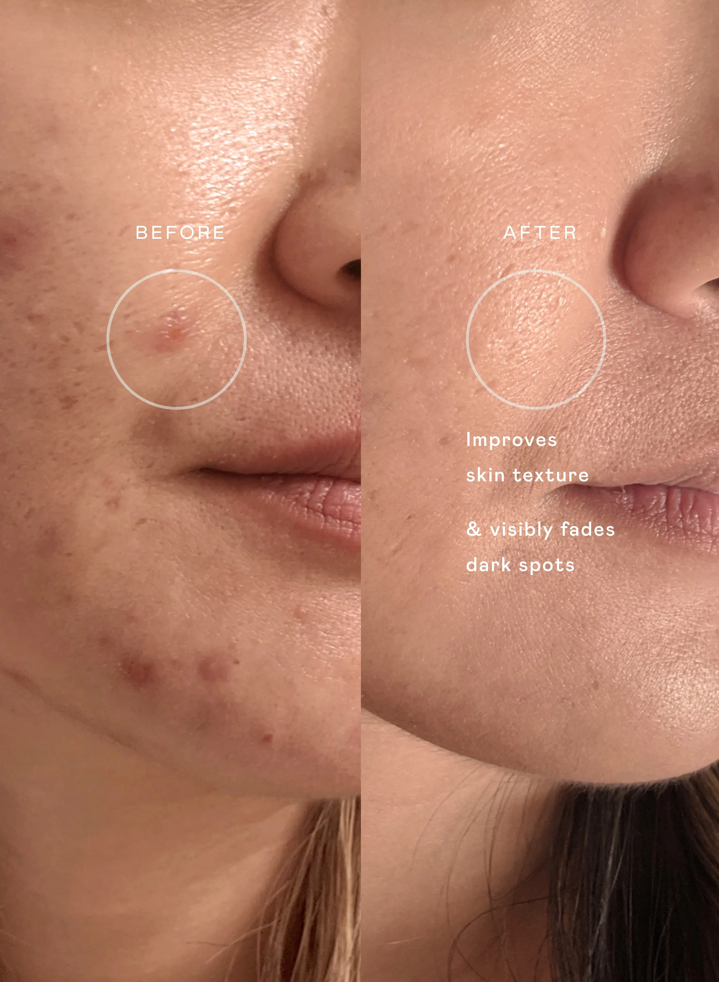 The Skin Renewal Set